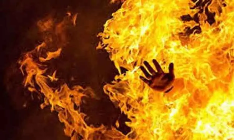 Pune Crime News | Mother-in-law sets man on fire in Chandan Nagar-Kharadi area