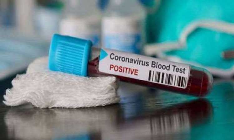 corona-blood-test