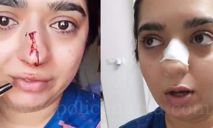 story woman cancel order after placing zomato delivery boy punched on her nose