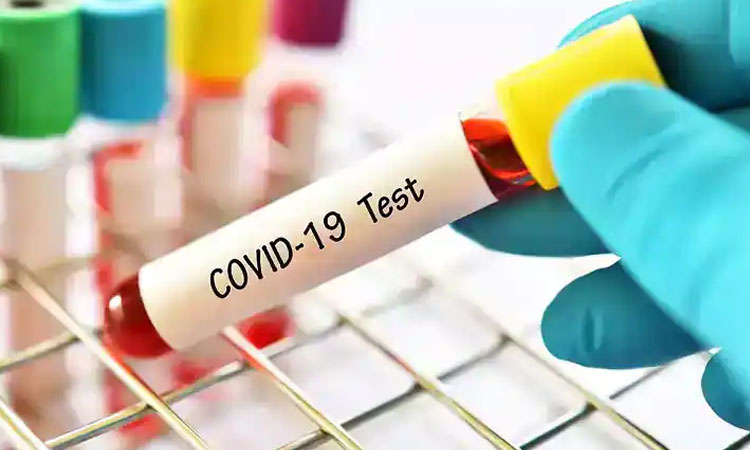 negative report even if you have symptoms of corona virus know what you have to do rtpcr test