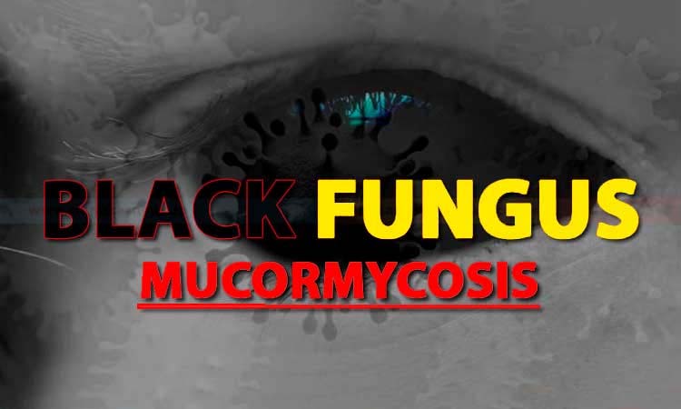 covid 19 black fungus infection pib fact check mucormycosis symptoms and treatment