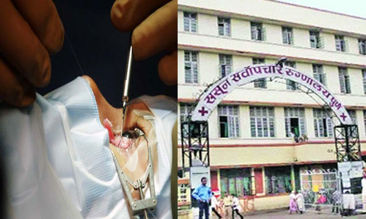 pune news 100 mucormycosis patient surgeries performed sassoon hospital pune