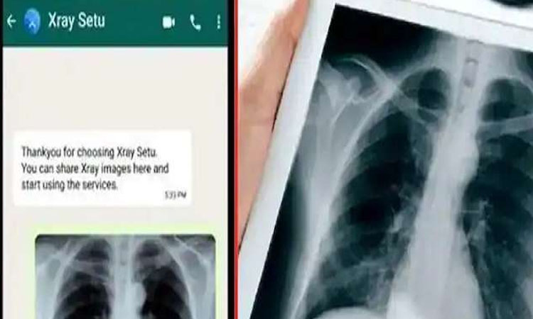 health how x ray images can help detect virus