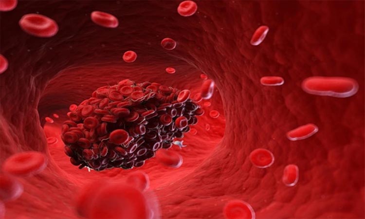 Blood platelets | coronavirus low blood platelets count symptoms health