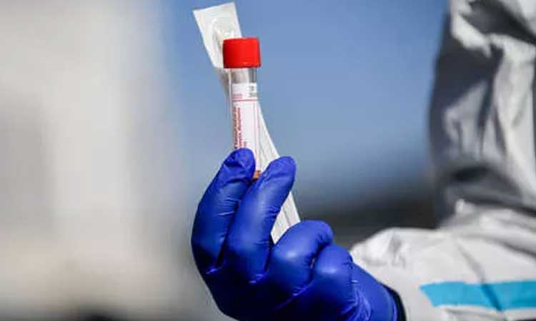 Nipah Test Kit | nipah test kit indias largest weapon nipahs result will come within hour