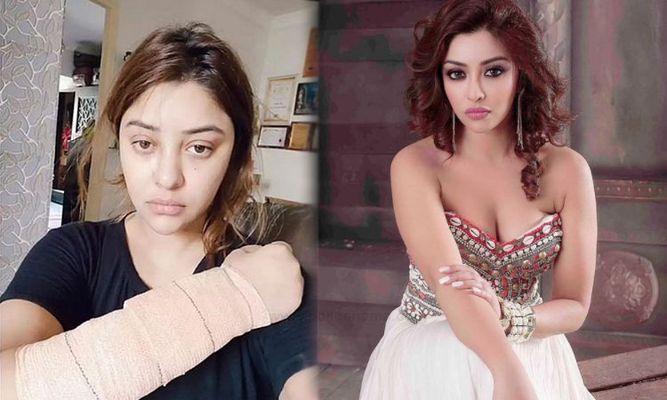 Actress Payal Ghosh | payal ghosh claims she escaped acid attack says got away with minor injuries