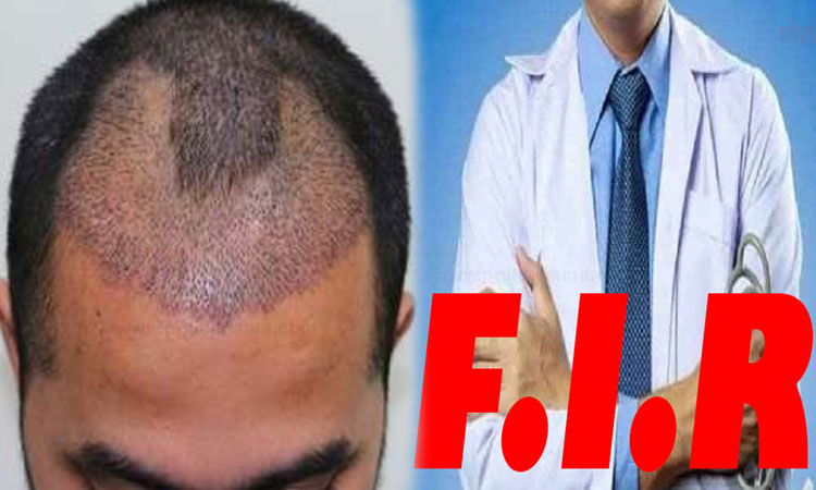 Pune Crime | Shocking ! Fake Doctor Shah Rukh alias Sameer Haider Shah done Hair transplant in Pune; Three including 2 women from Vimannagar area exposed FIR in Viman Nagar Police Station