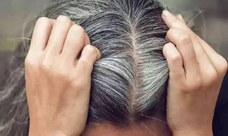 Hair Care Tips | hair care tips know solution to problem of white hair how to make hair strong