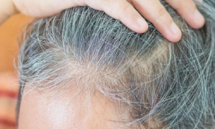 White Hairs Problem Solution | white hair problem solution know here home remedies for dark hair