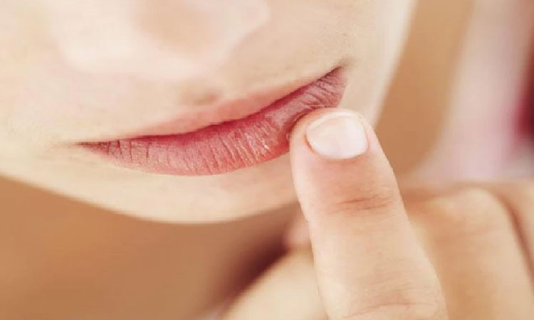 Cause Of Dark Lips | causes of dark lips hyperpigmentation
