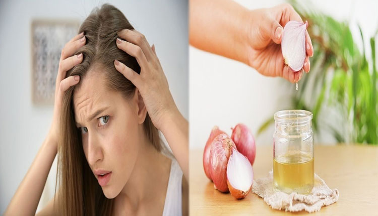 Onion Oil Benefits | onion oil benefits suffering from hair loss try this homemade onion oil you will get many benefits