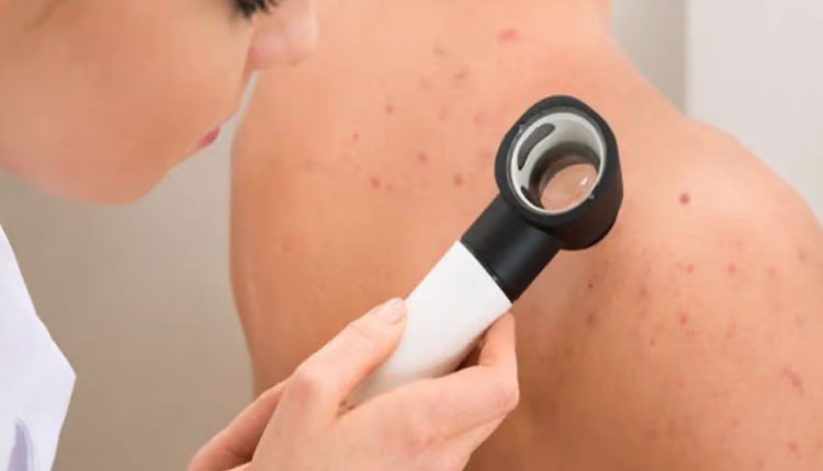Skin Cancer Prevention | how to prevent skin cancer know the risk factors and symptoms of skin cancer