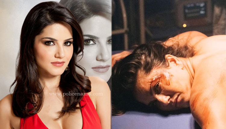 Sunny Leone Injured Photo | sunny leone became bloody photo lying on the operation table went viral