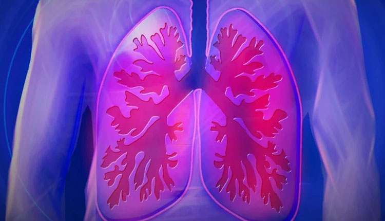 Symptoms Of Tuberculosis | symptoms causes types risk factors treatment