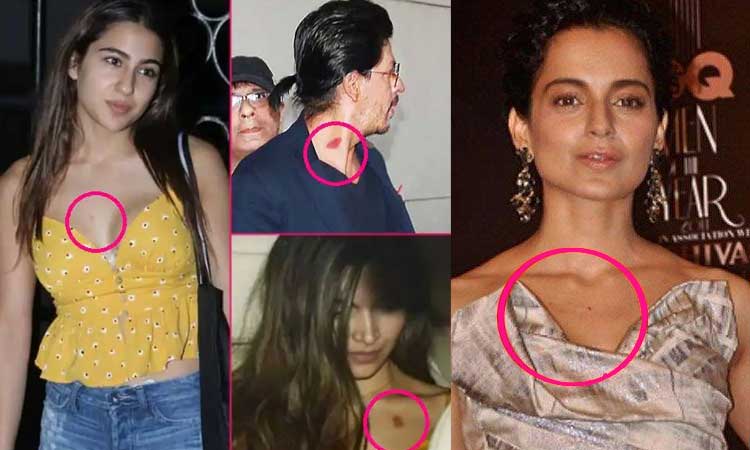 Celebrity Love Bite | celebrity and there love bite photos are trending on social media