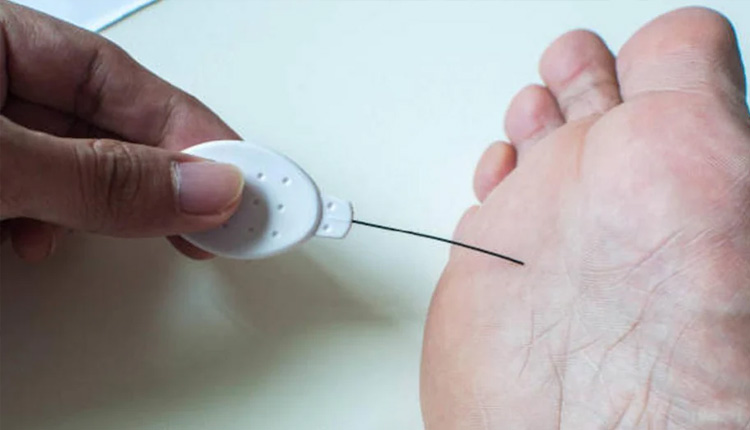Diabetes | diabetes foot amputations high rate fear could be avoided with better care