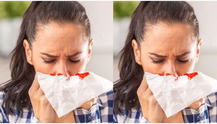 Nose Bleeding Problem | how to deal with nose bleeding problem during hot weather
