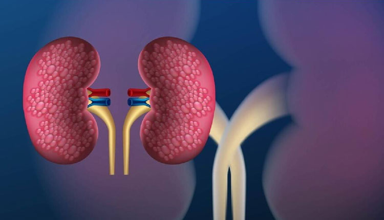 Kidney Cure | foods to avoid to keep kidneys healthy know what not to eat