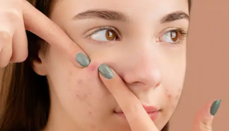 Skin Care Tips | amazing home remedies to get clear glowing and pimple free skin