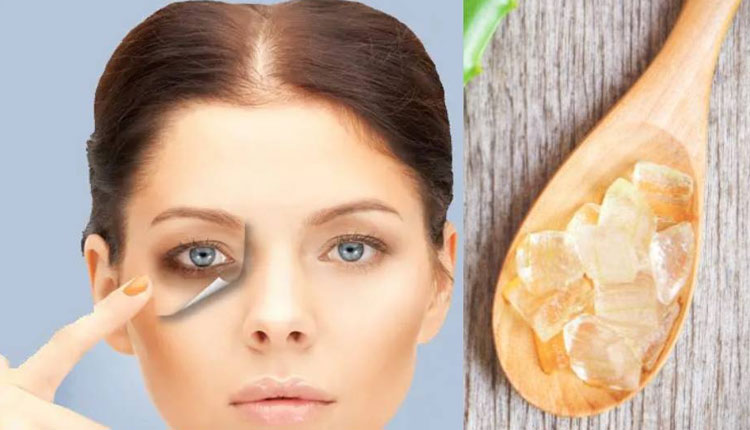 Skin Care Tips | skin care tips aloe vera gel to remove dark circles dark spots and wrinkles know anti aging tips