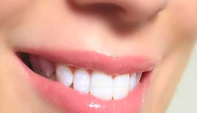 Natural Teeth Whiteners Fruits | these foods fruit are natural teeth whiteners home remedies