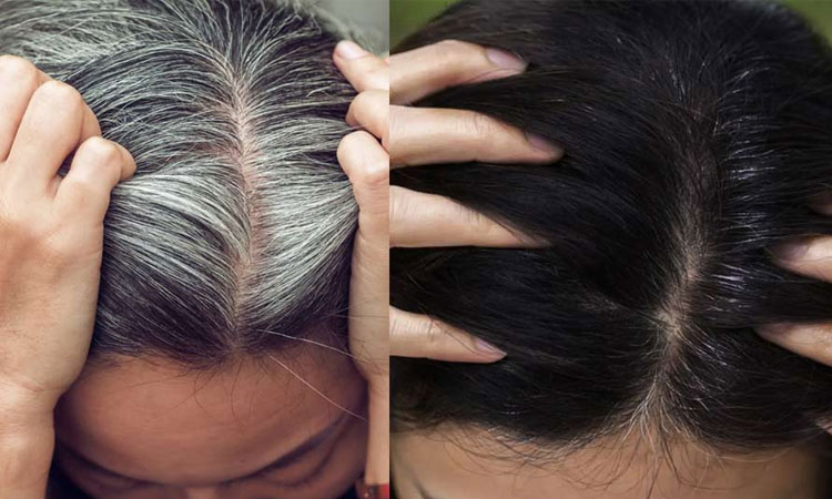 White Hair Problem | prematutre white hair problem solution flaxseed gel how to use it natural ways black