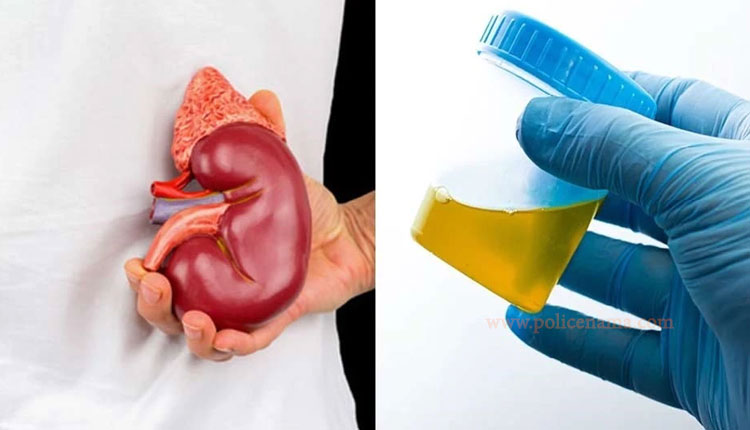 Kidney | kidney disease failure warning sign tiredness itching urine colour shortness of breath mouth