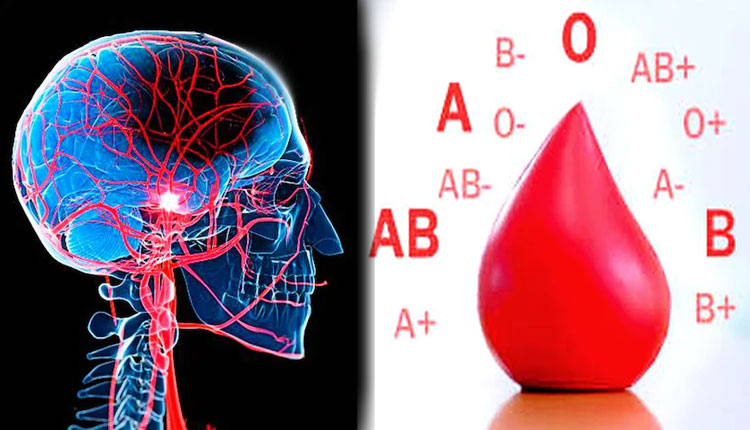 Stroke Risk | blood group type could predict your stroke risk a blood group is at higher risk
