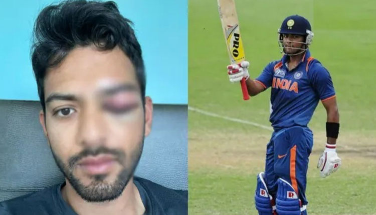 Cricket News | under 19 world cup winning captain unmukt chand get injured sport news