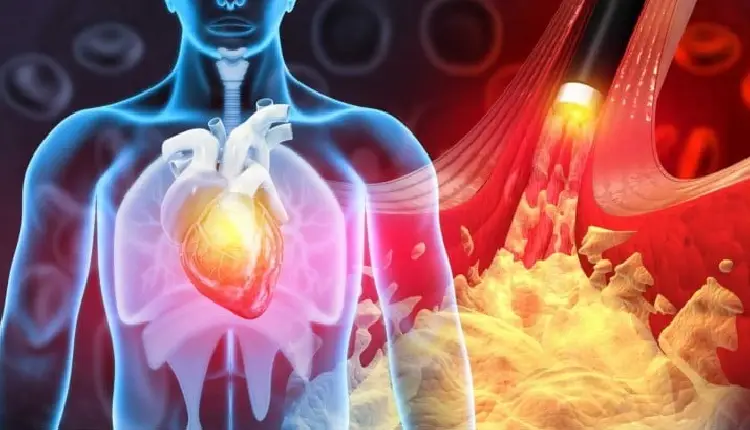 Heart Attack | why do people have heart attacks when dancing know all about its risk factors
