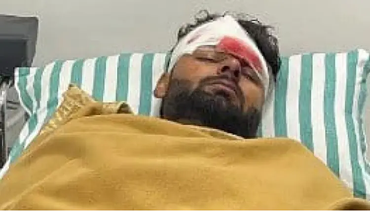 Rishabh Pant Injured In Accident | indias wicketkeeper rishabh pant injured in accident on delhi dehradun highway