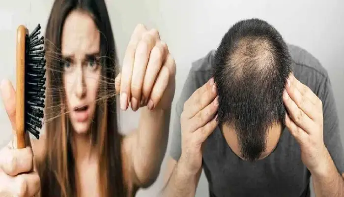 Hair Fall Problem | how to avoid becoming a victim of baldness