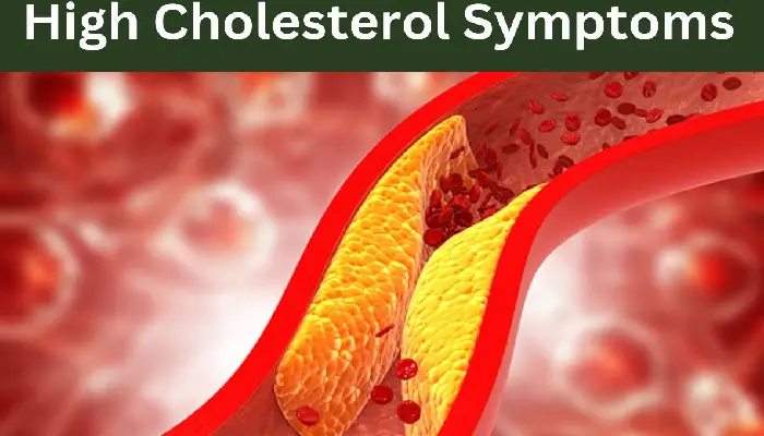 Cholesterol | how to detect the cholesterol level cold sole feel pain in leg ldl level heart attack risk