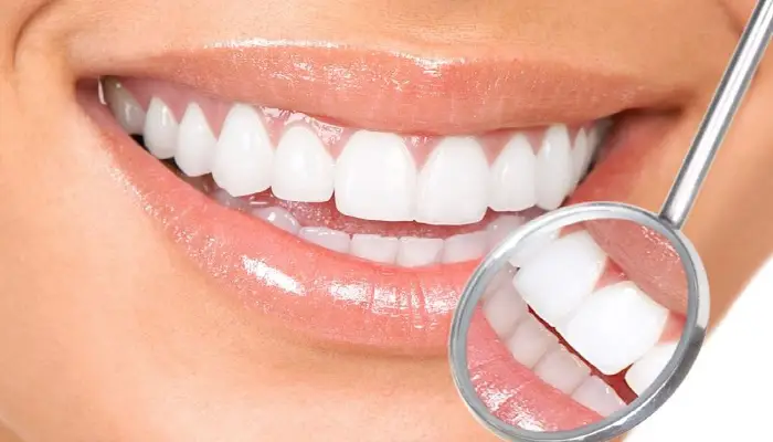 Dental Cavity | how-to-get-rid-of-dental-cavity-with-home-remedies-for-bacteria-free-strong-teeth